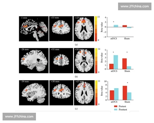 现代体育科学视角下运动表现提升机制与健康优化研究 现代体育科学视角下运动表现提升机制与健康优化研究